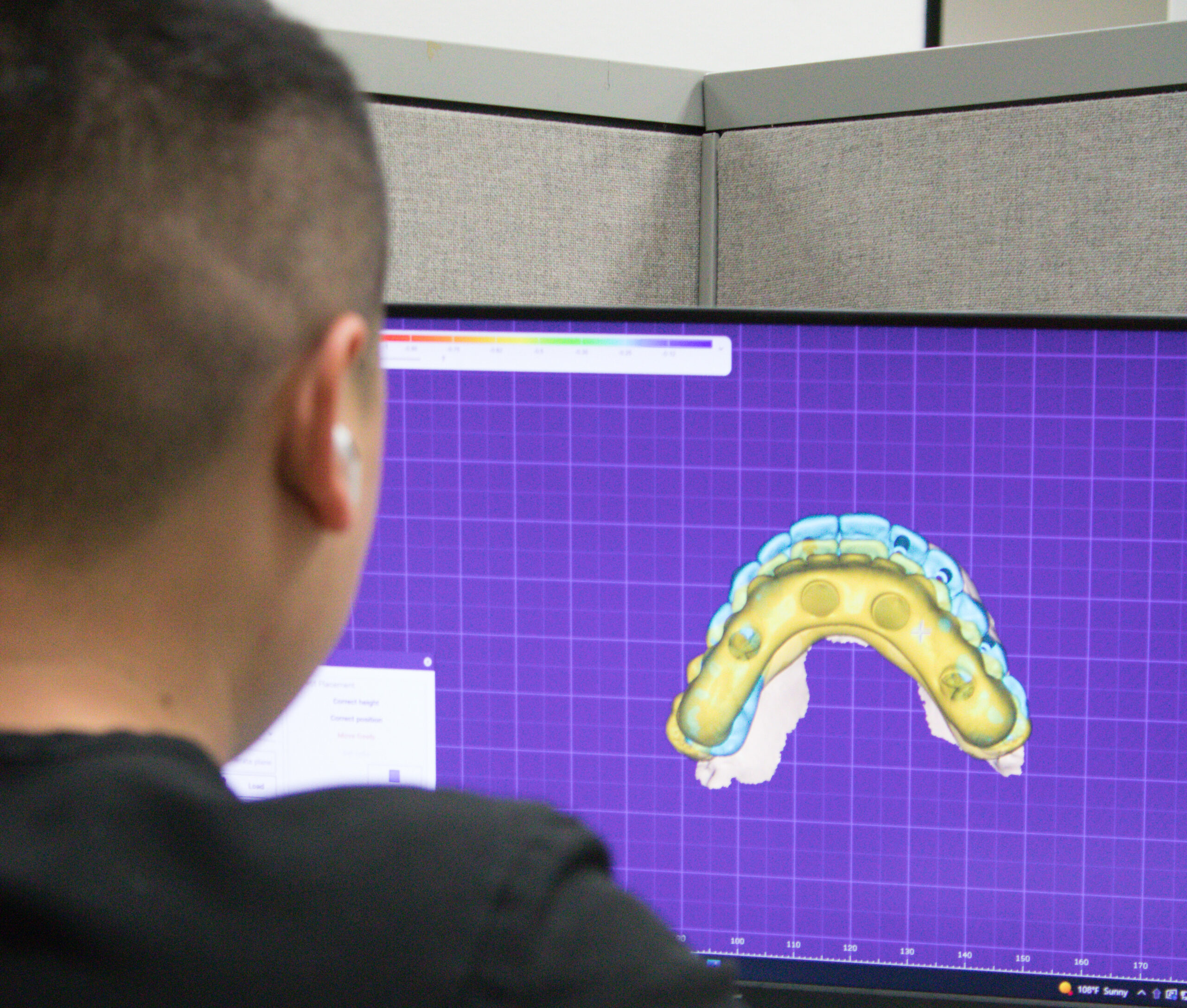 Dental technician working on a exocad digital drawing of hybrid set of teeth.
